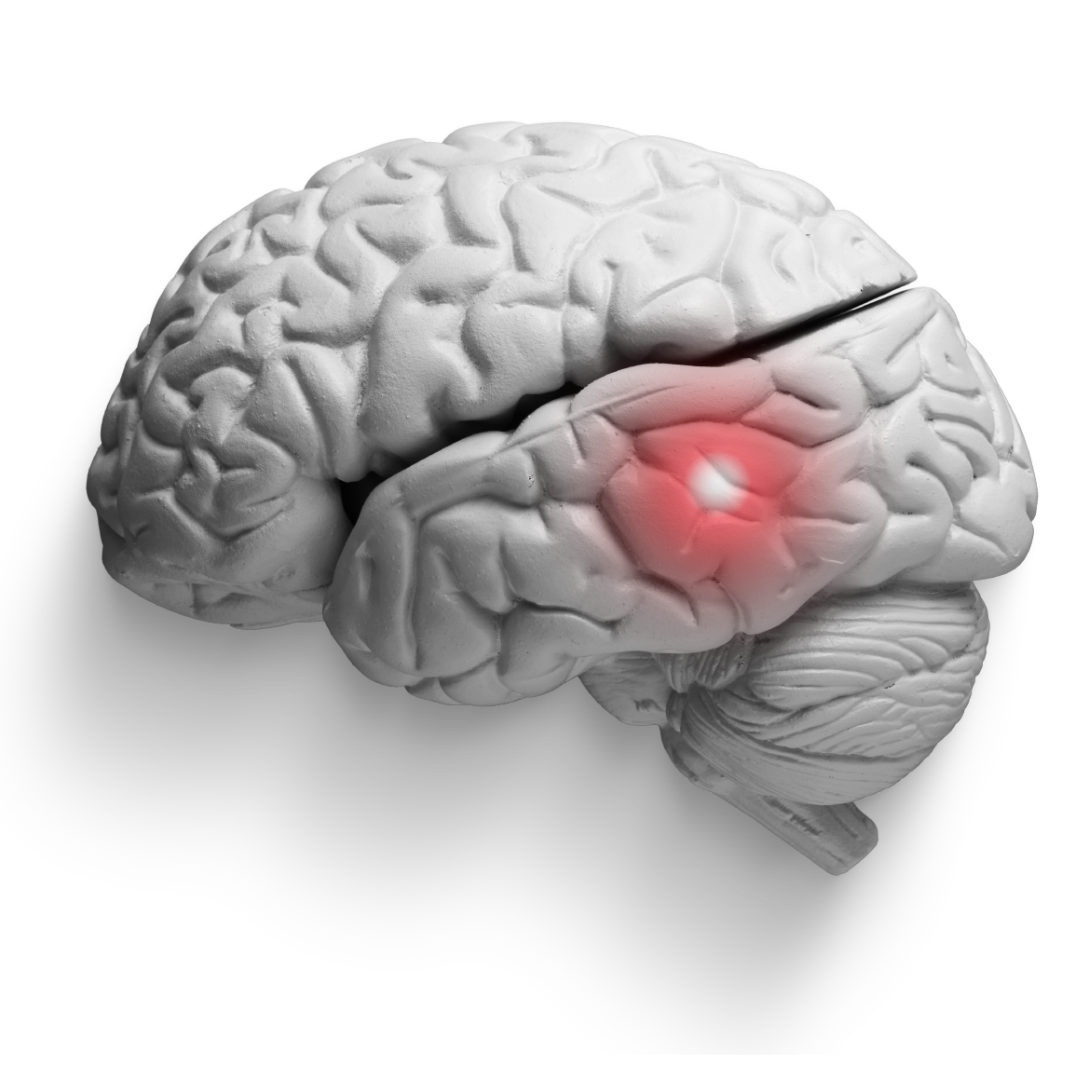 Brain Brain