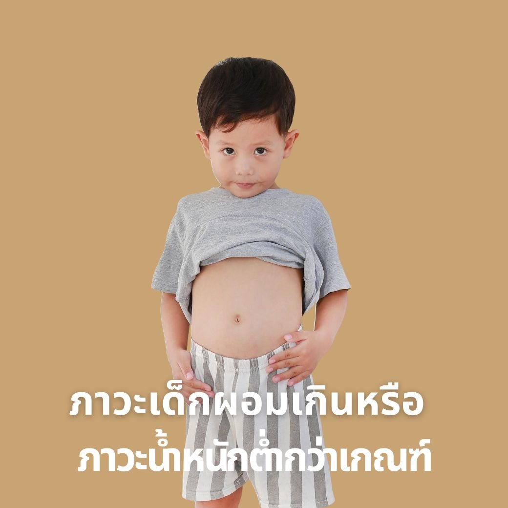 ภาวะเด็กผอมเกิน